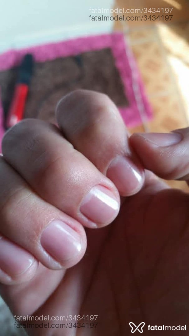 Imagem 3