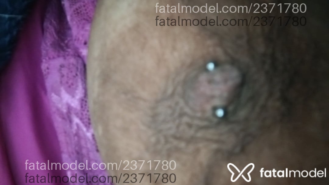 Imagem 4