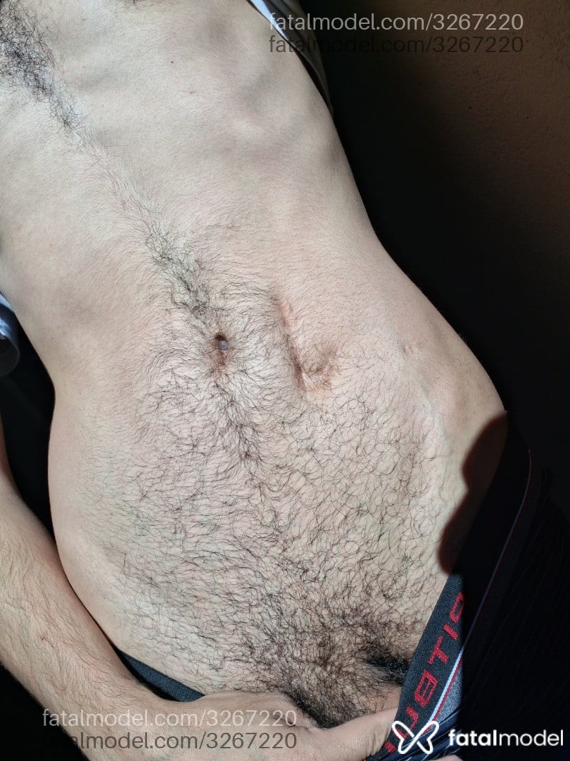 Imagem 3