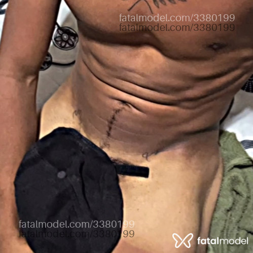 Imagem 1