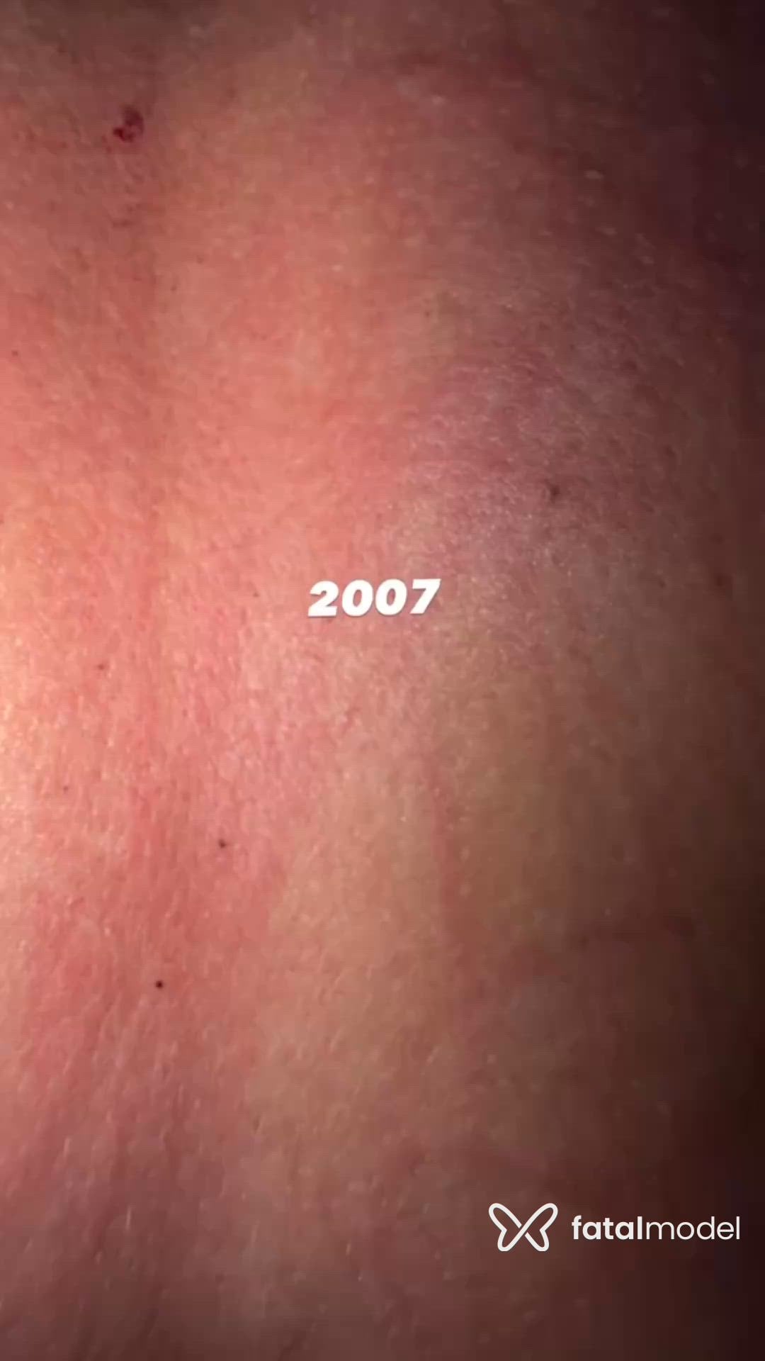 Acompanhante mulher morena (o) de olhos castanhos - Lin Sfd
