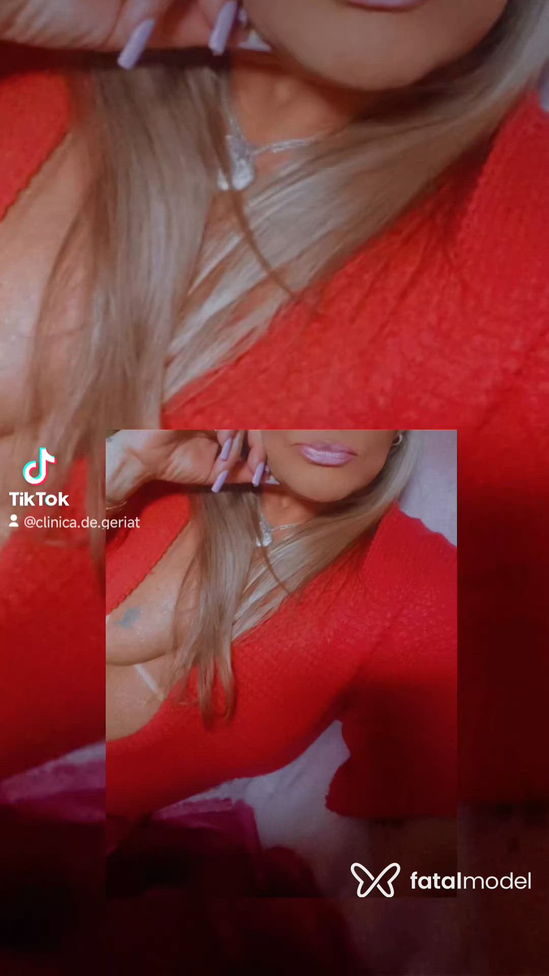 Vídeo 2