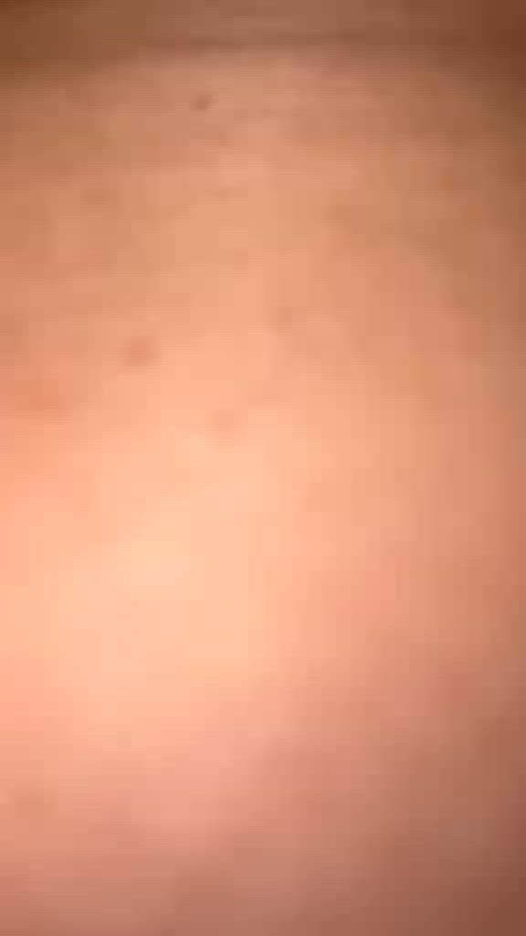 Vídeo 2
