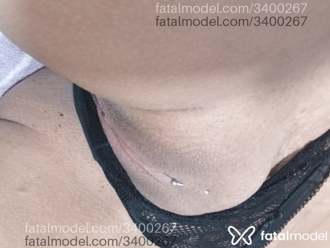 Imagem 3