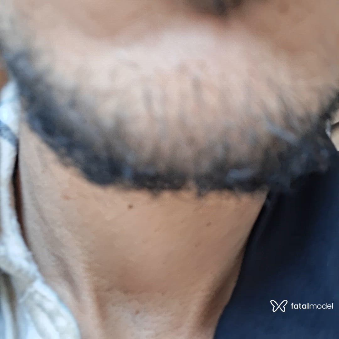 Vídeo 11