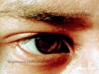 Imagem 3