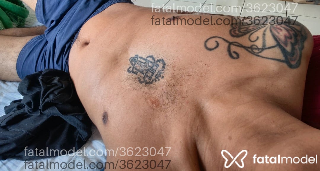 Imagem 3