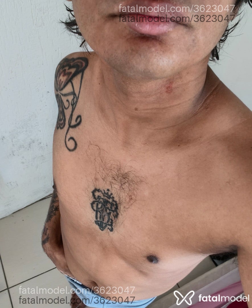 Imagem 2