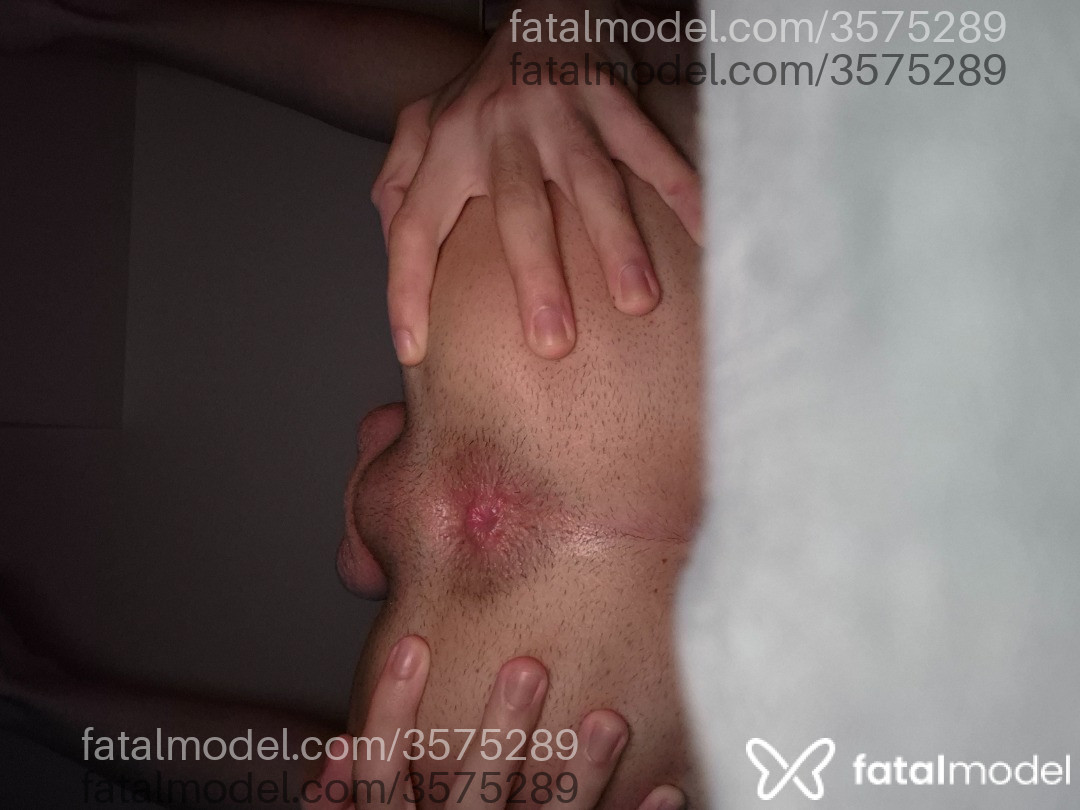 Imagem 3