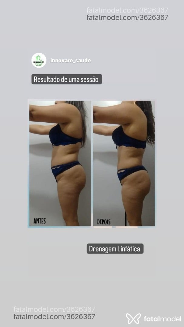 Imagem 8