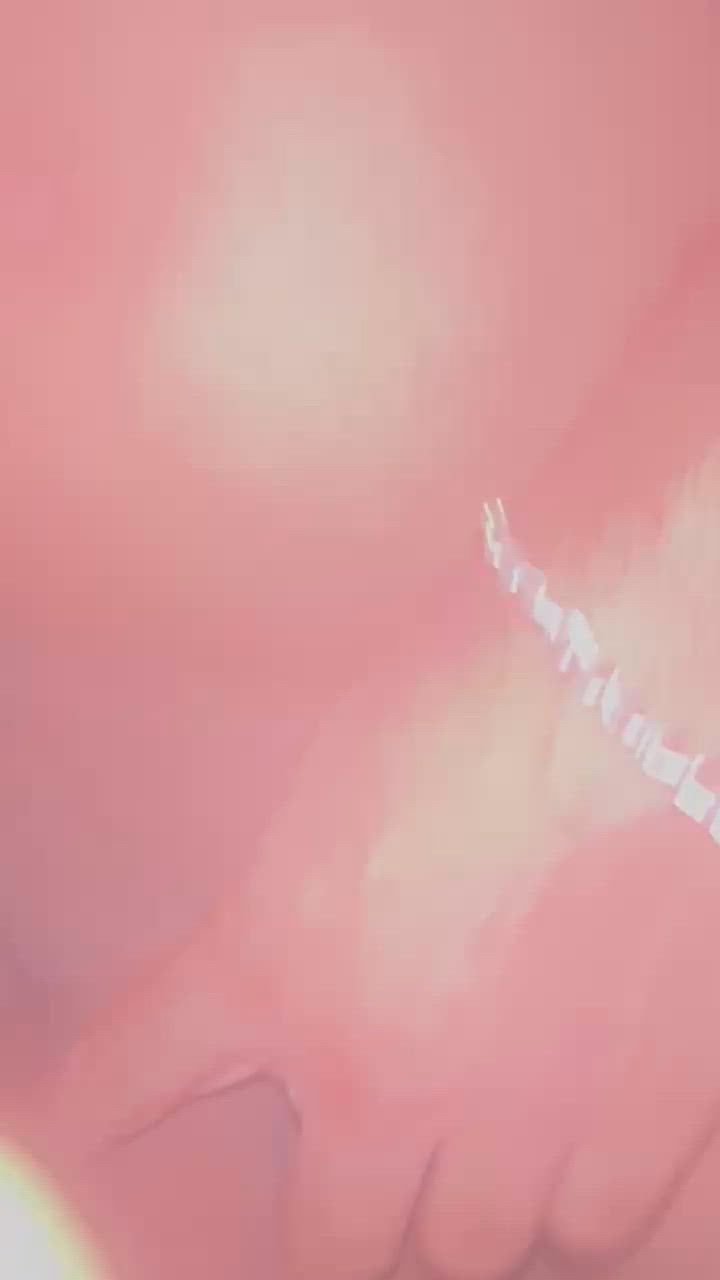 Vídeo 1