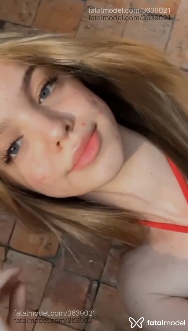 Imagem 2