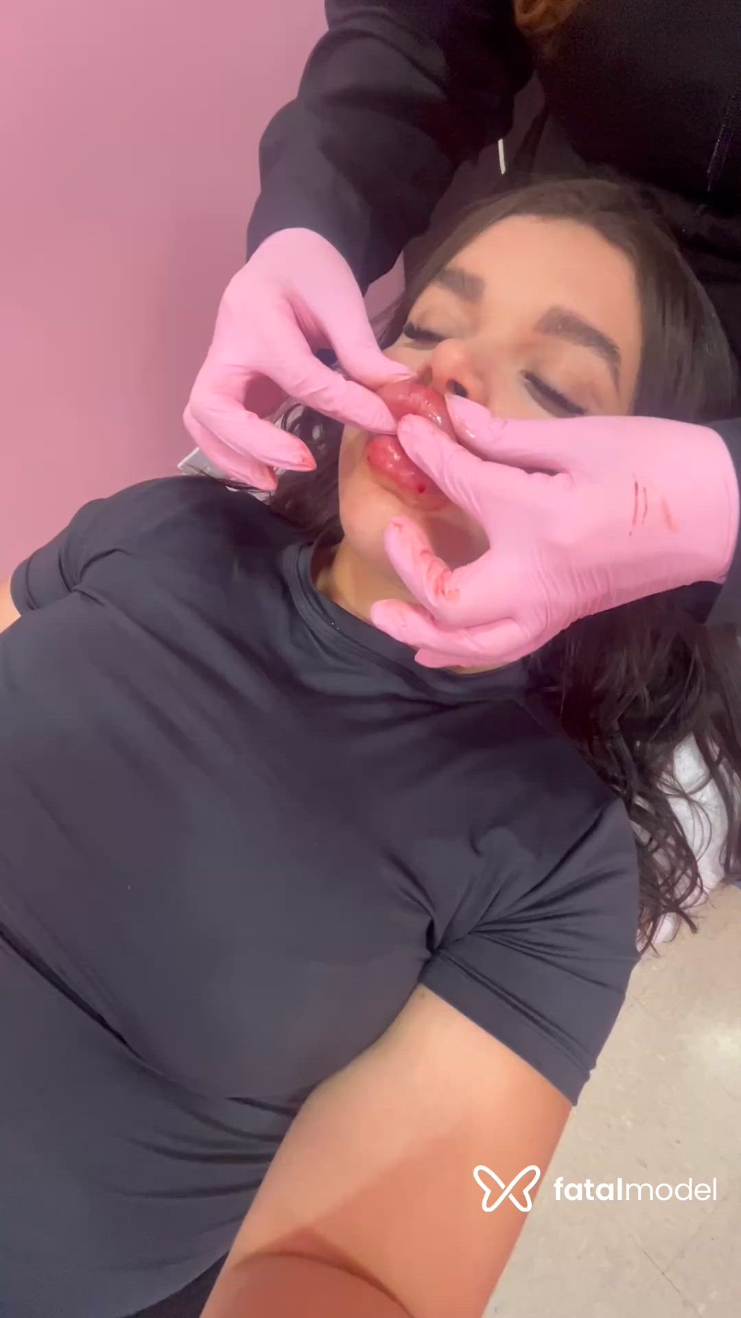 Vídeo 9