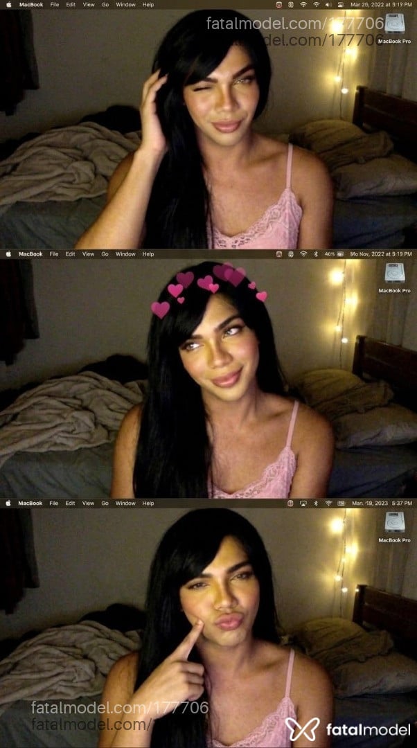 Imagem 11