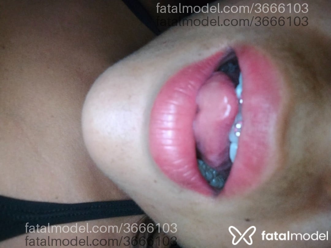 Imagem 3