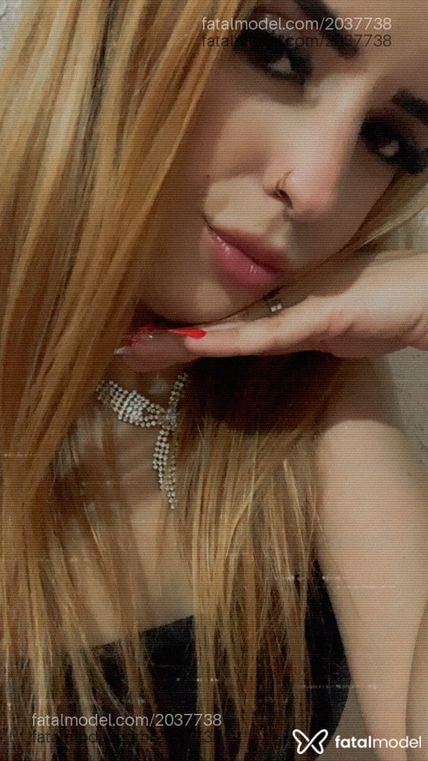 Imagem 3