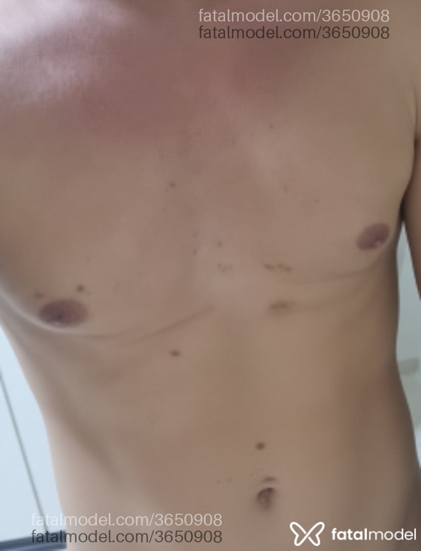 Imagem 2