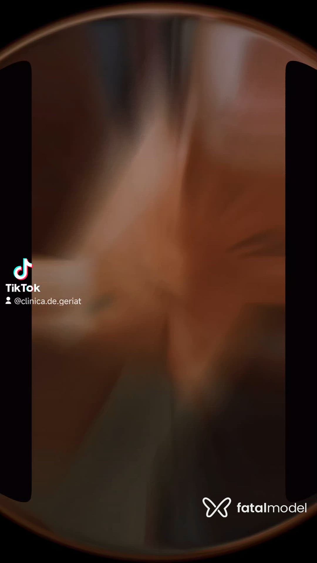Vídeo 2