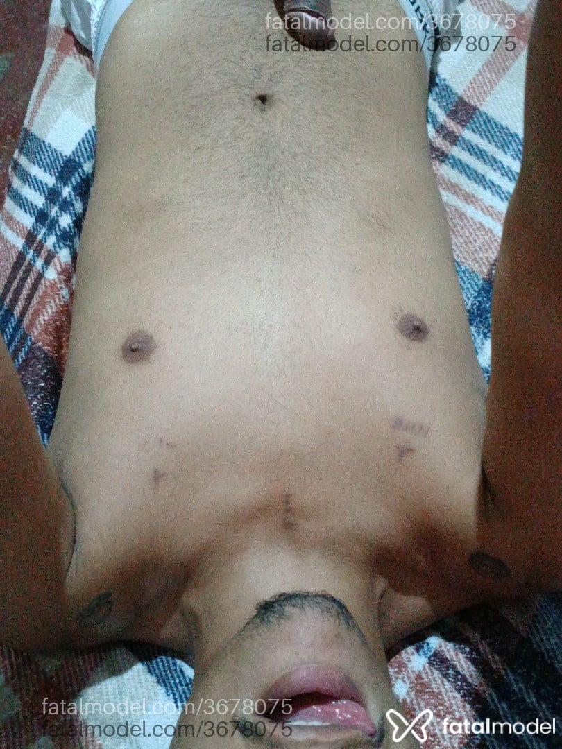 Imagem 4