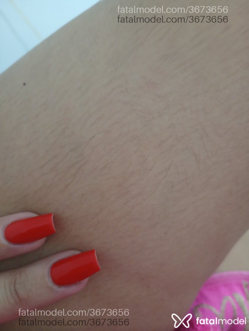Imagem 3