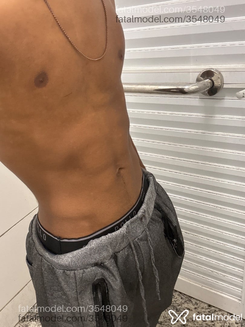 Imagem 3