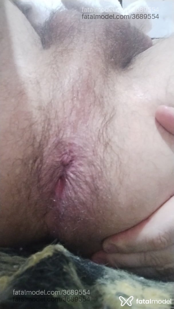 Imagem 3