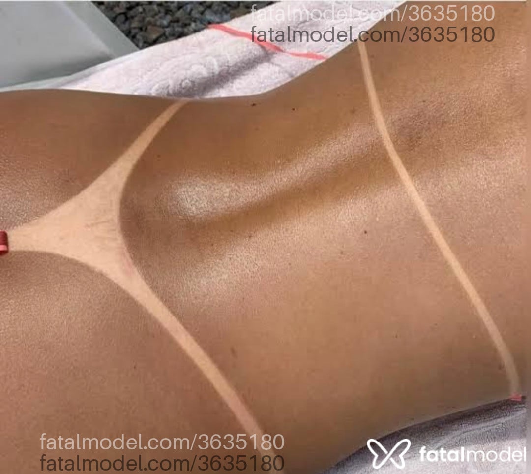 Imagem 3