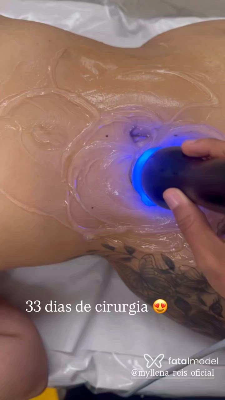 Vídeo 10