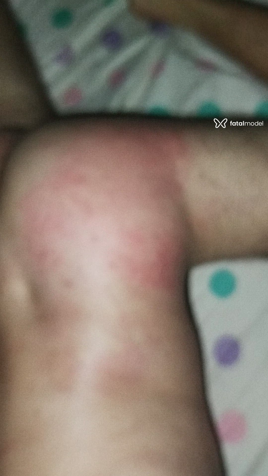 Vídeo 1