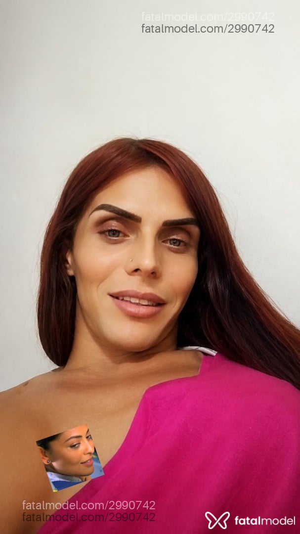 Imagem 1