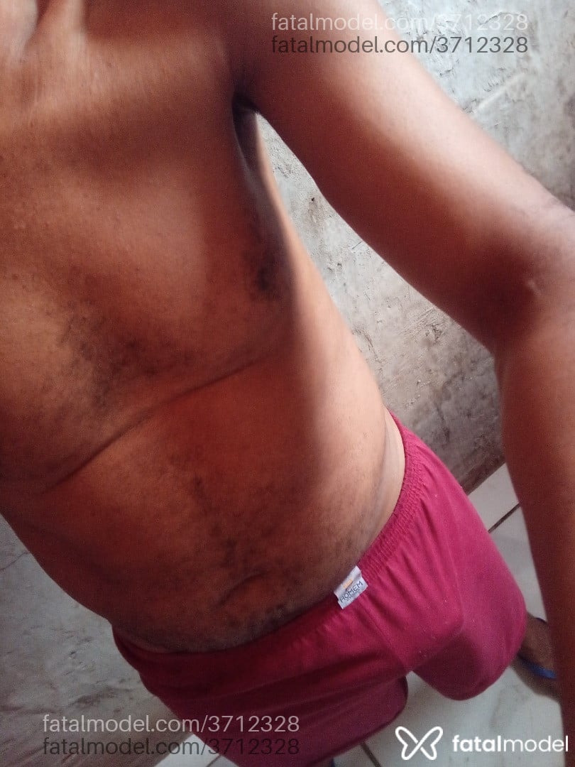 Imagem 2