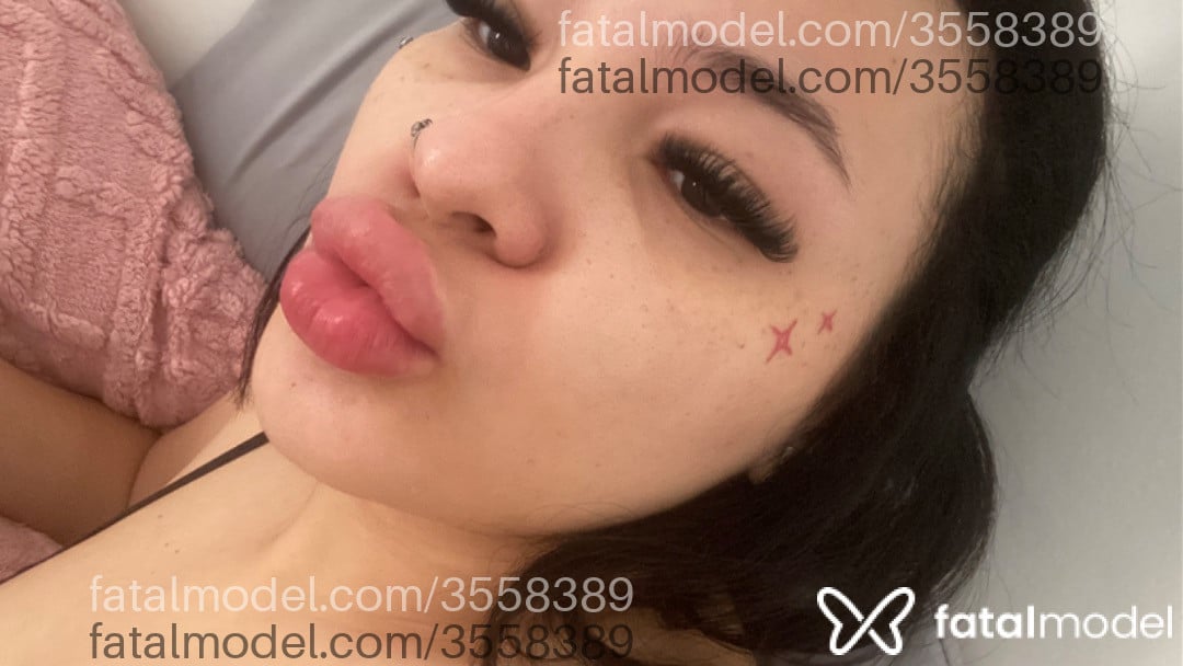 Imagem 3