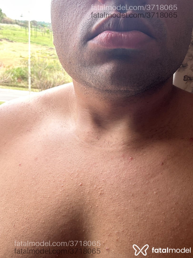 Imagem 1