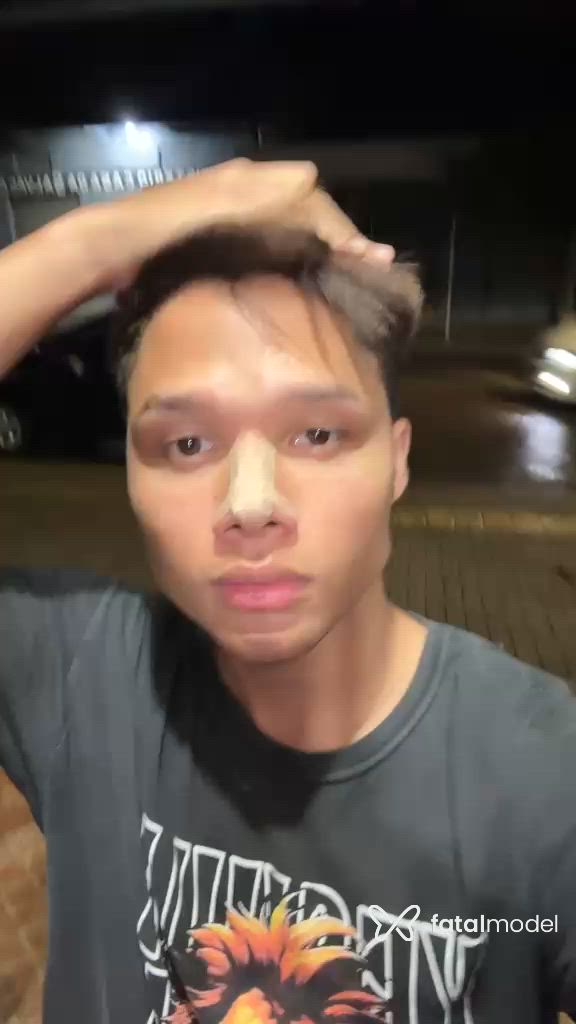 Vídeo 9