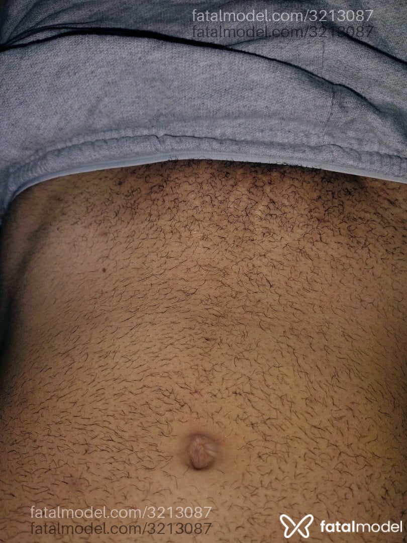 Imagem 3