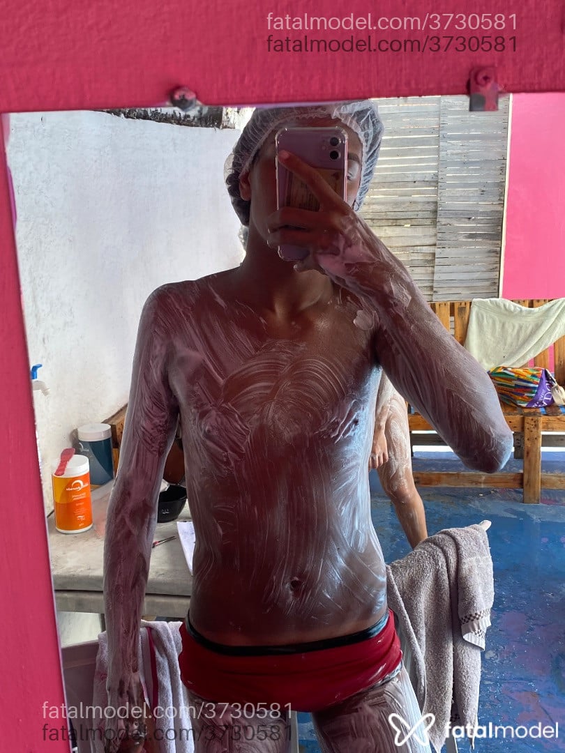 Imagem 2