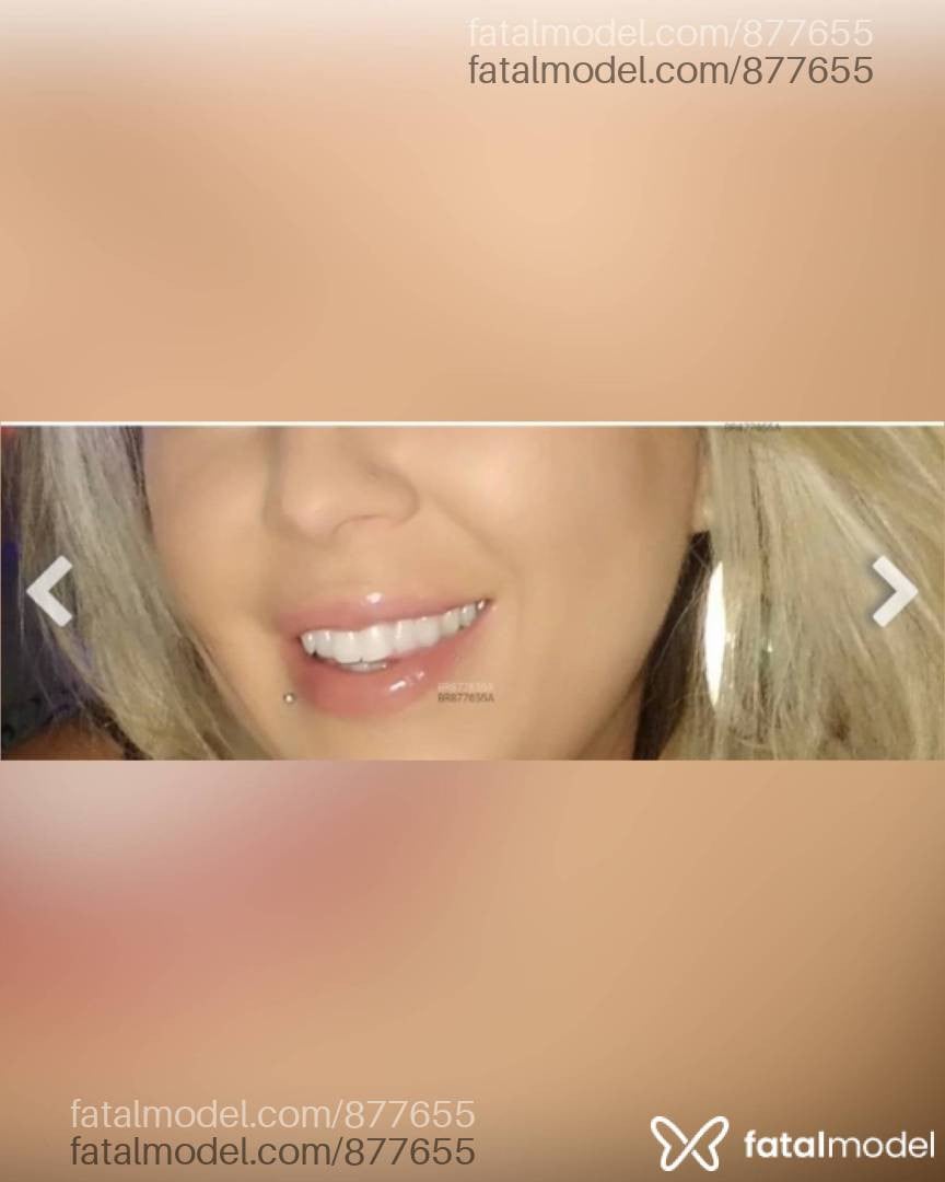 Acompanhante mulher loira (o) de olhos mel - Babi Loiraçatop